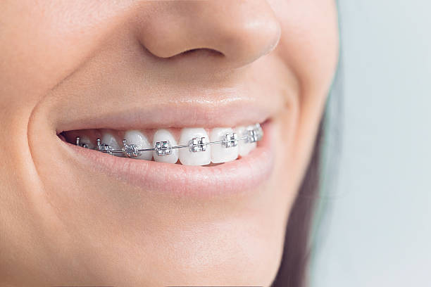 Best Traditional Braces  in Marlin, TX